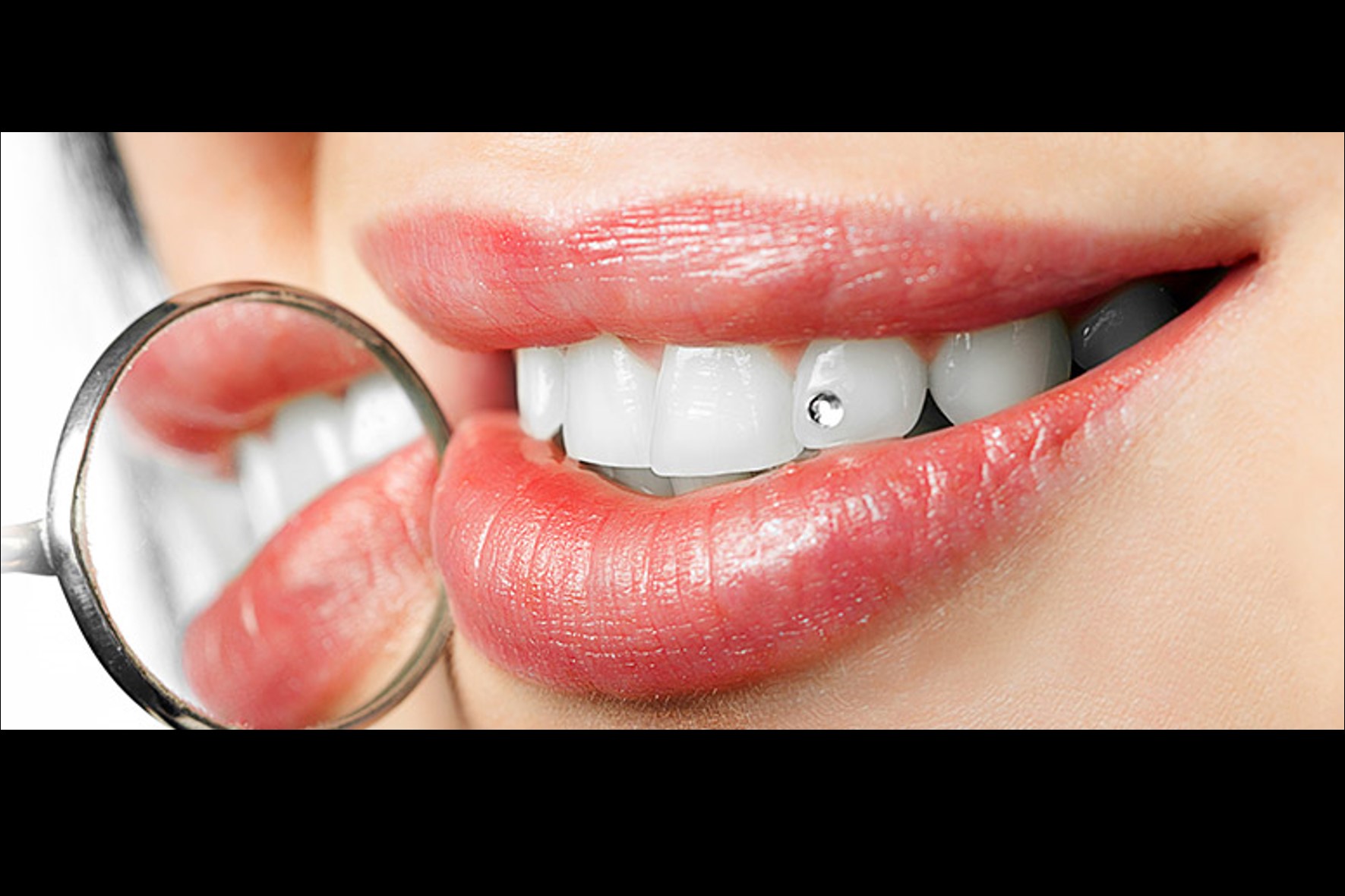 Tooth Jewellery Dentist in Mysore