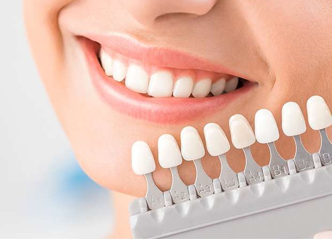 tooth-filling-dentist-sensitive-teeth-tooth-decay-treatment-tooth